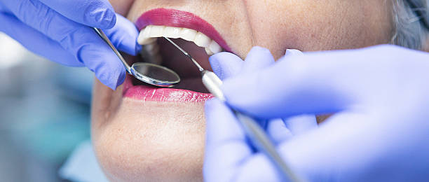 Best Emergency Treatment for Toothache in Lawton, IA